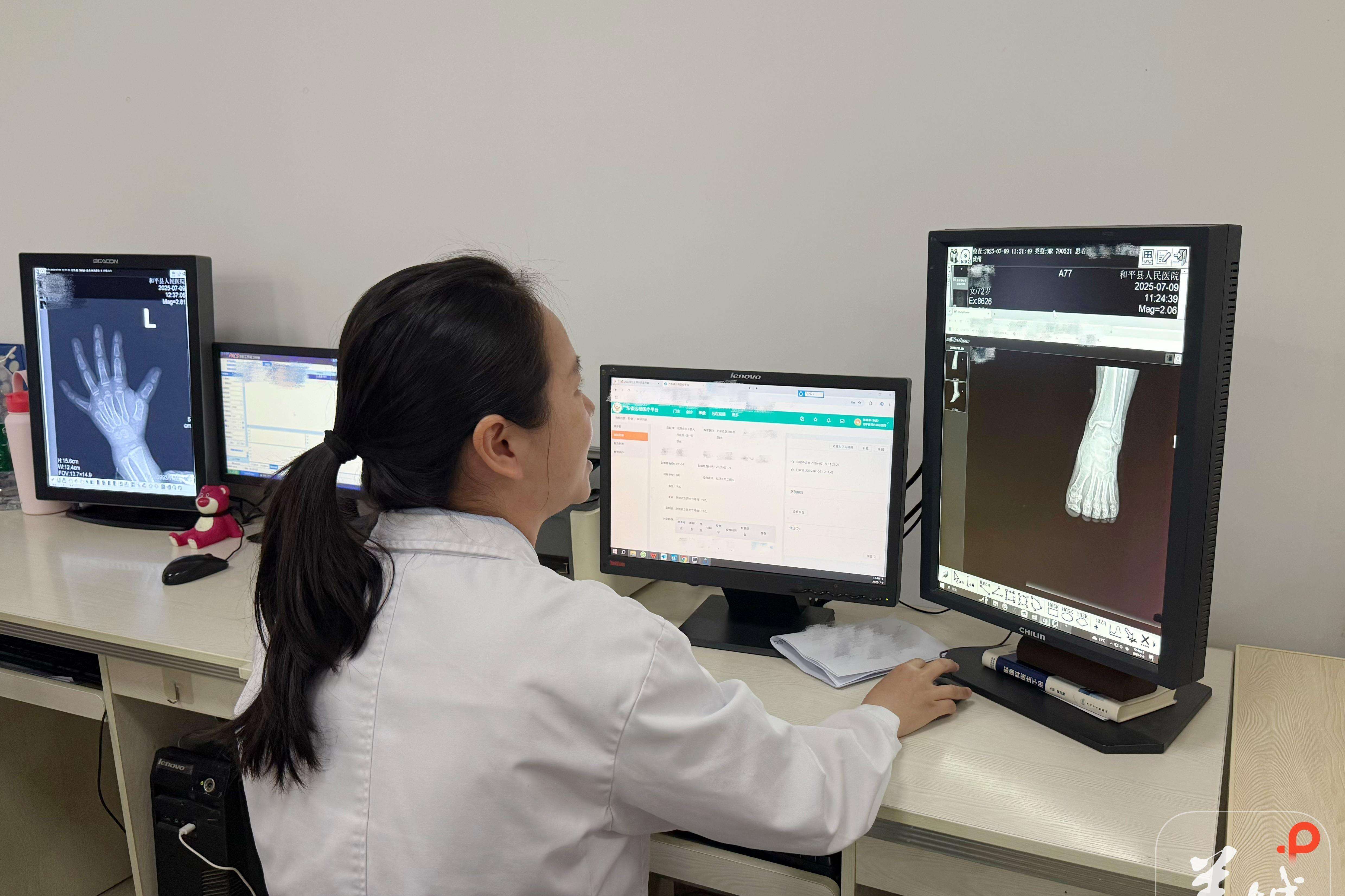 AI-assisted medical image system launched across Guangdong, with results in just 2 seconds